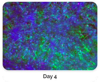 Live Cell Staining with Fluorescence Dyes day 4